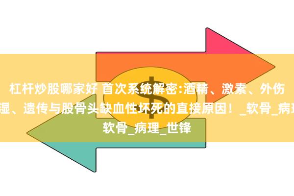杠杆炒股哪家好 首次系统解密:酒精、激素、外伤、类风湿、遗传与股骨头缺血性坏死的直接原因!_软骨_病理_世锋